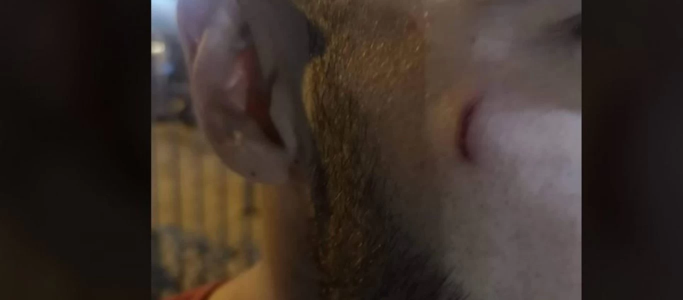 Ηλιούπολη: Χαράκωσαν τερματοφύλακα ερασιτεχνικής ομάδας σε φιλικό